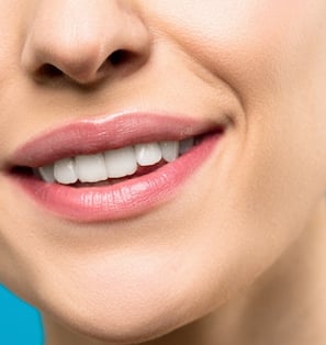 Remedios caseros para blanquear los dientes