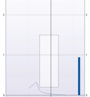 a type C tympanogram chart