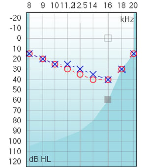 A high frequency audiogram