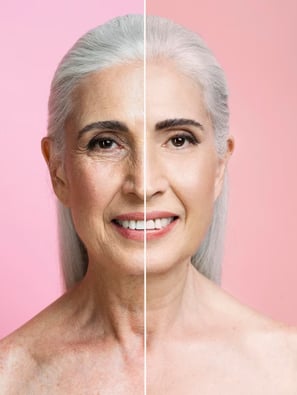 high-end-photo-retouching-remove wrinkles 