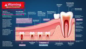 Gum disease