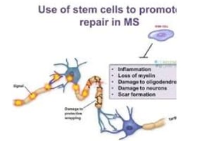 stem therapy use = fasting