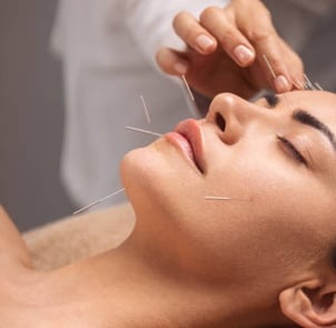 Acupunture