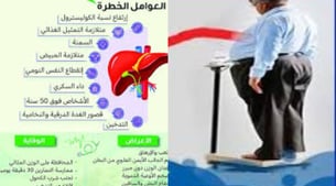 حالات مرض الكبد الدهني عوامل الخطر