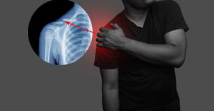 Shoulder Dislocation-  Dr. T. Aravindh MBBS, MS( ORTHO)