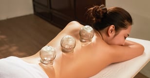 Une femme sur une table de soins se fait poser des ventouses, ou de la cupping thérapie