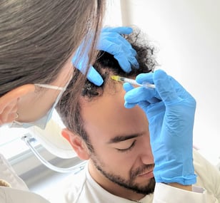 Mesoterapia capilar