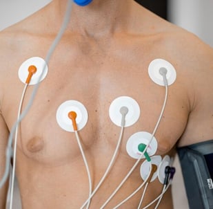 eletrocardiograma (ecg) e eletroencefalogra (eeg) e espirometria