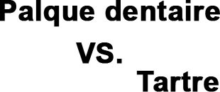 plaque dentaire et tartre
