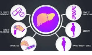 Fructose and Health Relationship with Obesity, Fasting (2)