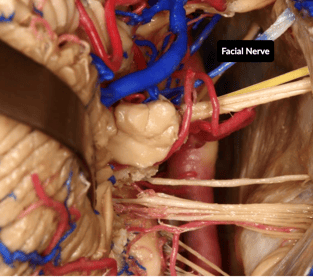 VEINOUS INVOLVEMENT