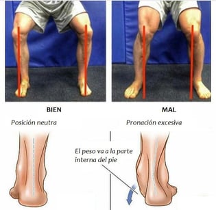 Comparativa de sentadilla bien alineada vs. con desalineación de rodilla