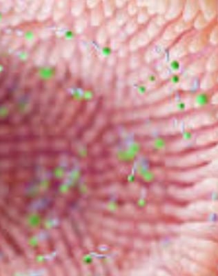 The Impact of Microbiome, Fasting, and Probiotics on Cancer (4)