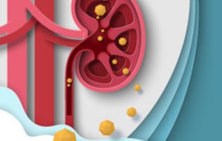 Renal Stones