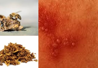 effectiveness as strong antiherpetic agents.