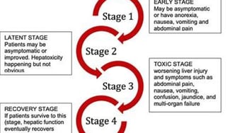 stages