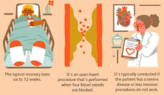 by pass heart surgery