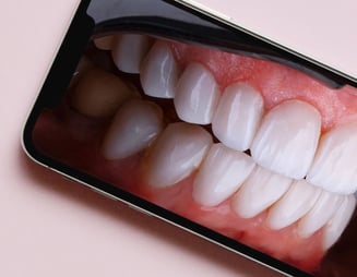 odontologinės fotografijos mokymai išmaniuoju telefonu