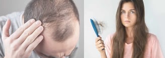 Hair Growth RX ray and rio's speciality clinic