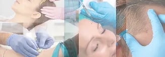 PRP ray and rio's speciality clinic