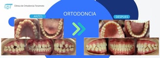 tratamiento de ortodoncia