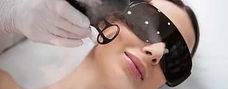 Acne Scars ray and rio's speciality clinic