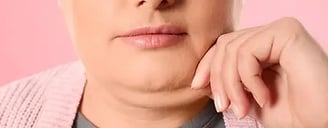 Double Chin ray and rio's speciality clinic
