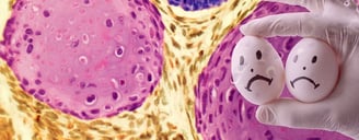 Testicular Cancer  ray and rio's speciality clinic