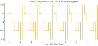 A graph of a Typical Sleep Architecture over 8 Hours (Hypnogram)