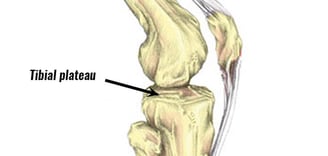 Tibial Plataeu-  Dr. T. Aravindh MBBS, MS( ORTHO)
