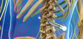 Nerve Blocks-Dr. T. Aravindh MBBS, MS( ORTHO)