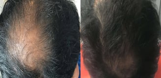 Before and After