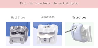 brackets