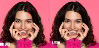 teeth-color-correction