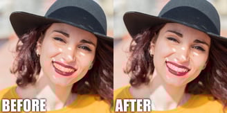 before and after teeth whitening fashion editing