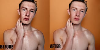 High-end Skin Retouching Before and After 