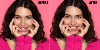 teeth-whitening-and-eye-correction