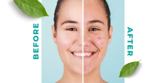 Allors Skin Care Before and After Blog Post feature image of a woman with results after using Allors Products