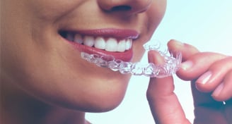 aparat dentar pret