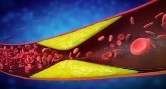 Como os níveis de triglicerídeos afetam a saúde cardiovascular?