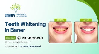 teeth whitening in baner