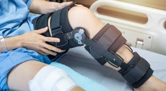 Knee Fracture-  Dr. T. Aravindh MBBS, MS( ORTHO)