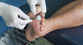diabetic sores on feet