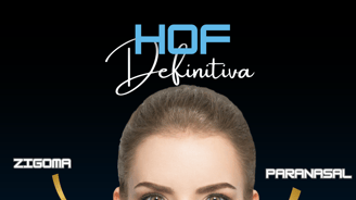 harmonização definitiva