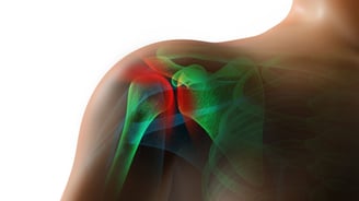 Frozen Shoulder - Dr. T. Aravindh MBBS, MS( ORTHO)