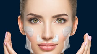 tipos de implante facial