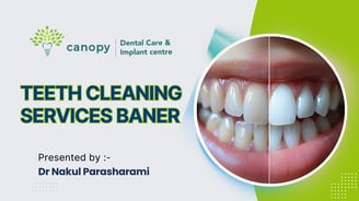 teeth cleaning services in baner