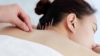 dry needling therapy for cervical pain to release trigger points.