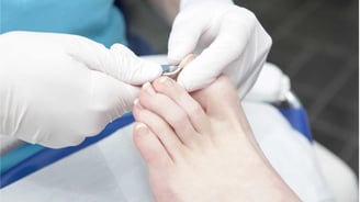 Layanan Kuku Cantengan Klinik Sehat Plus BSD
