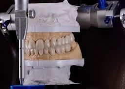Modelos articulados e reabilitação Dentista 24 Horas